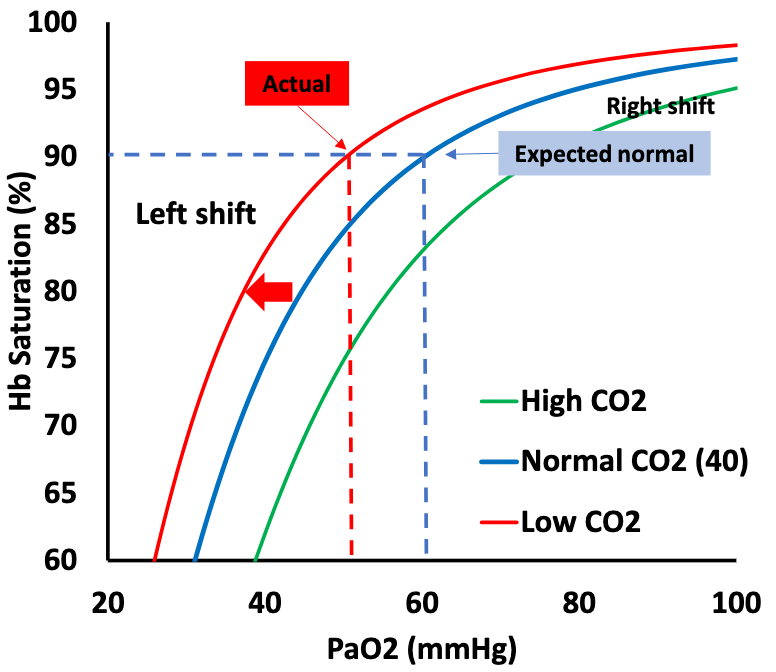 Screenshot 2024-03-04 at 17-58-36 MP-July-2020-Beyond-Pulse-Oximetry-to-Pulmonary-Gas-Exchange-Measurement-in-COVID-19-71320.pdf